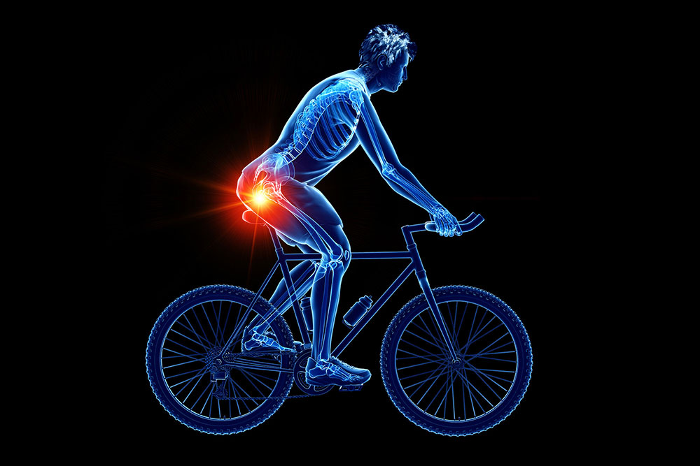 Jak předcházet a jak se zbavit bolesti sedacího nervu po jízdě na kole?